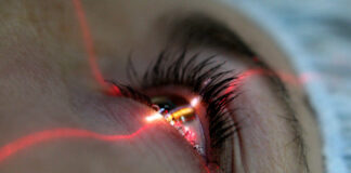 Что нужно знать о лазерной коррекции зрения?