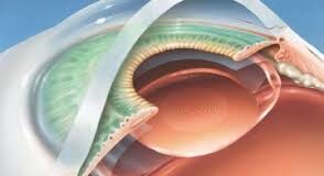 Основные симптомы и лечение катаракты